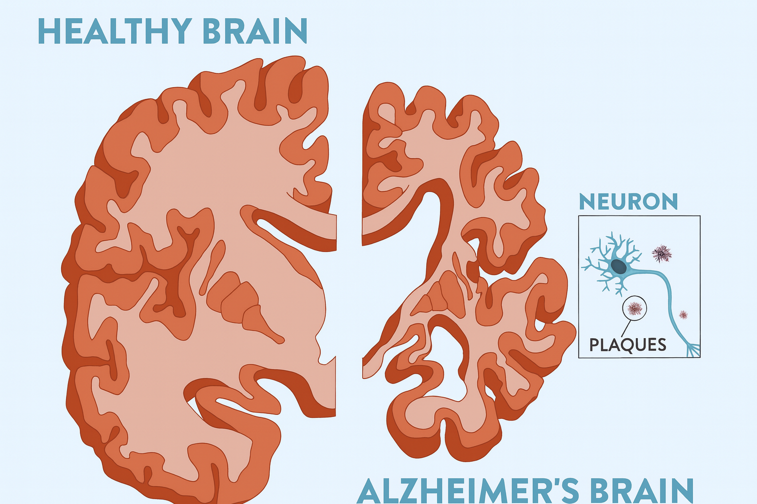 Alzheimerova choroba: Když mozek ztratí své světlo